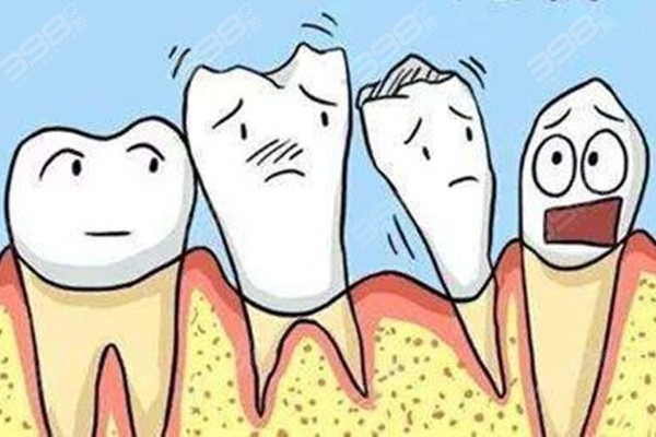 牙齿越变越长是怎么回事？看看是不是牙龈萎缩惹的祸
