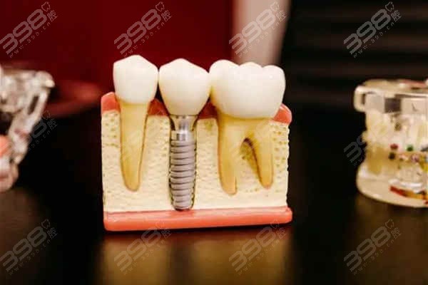 上海长宁区牙防所价格表找到了,补牙300起、牙齿矫正9800起、种植牙3540起