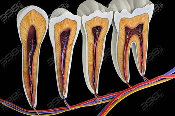 牙神经长什么样子？通过取出来的牙神经图片了解