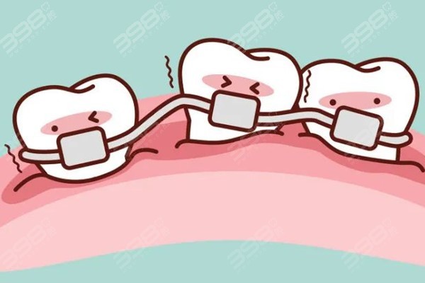 贵阳牙齿矫正一般要花费多少钱