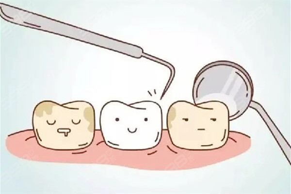 杭州瑞创口腔牙齿美白流程