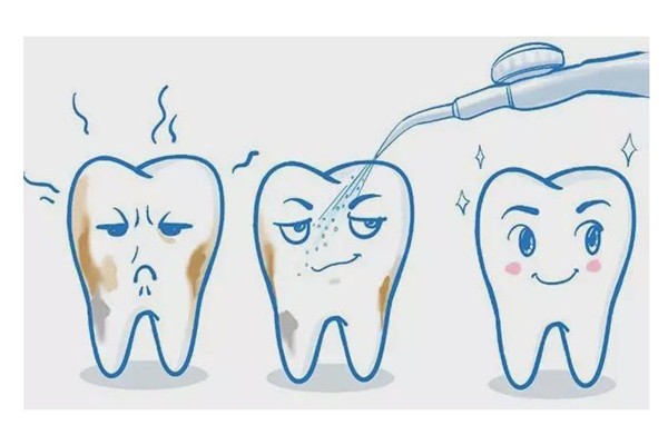 洗牙正规流程到底是怎么样呢？洗牙可以让牙齿变白吗