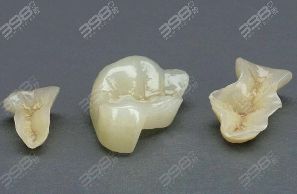 嵌体修复和补牙的区别有哪些？哪个使用的寿命会更久？