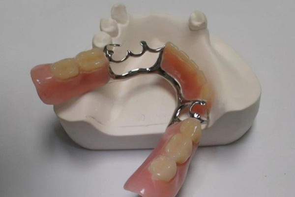 半口活动假牙多少钱？牙齿缺失后修复种类及价格大盘点！
