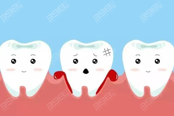 常见的口腔疾病牙周炎