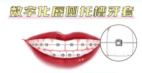 上海金山区牙齿矫正多少钱？