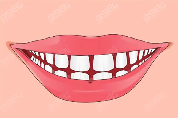 牙缝越来越宽是什么原因造成的？我们面对牙缝变大该怎么办？