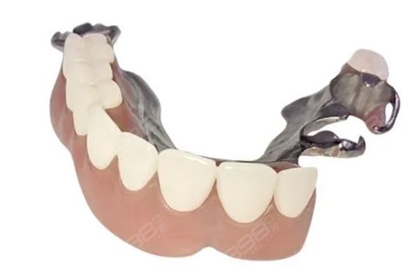 无锡口腔医院全口假牙价格：装假牙包含钛合金、吸附性义齿多少钱