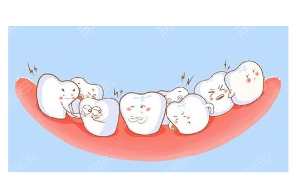 根管治疗后还能矫正牙齿吗？别被牙医引导进入正畸误区！
