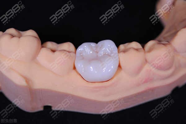 牙冠集采价格新消息：2023全瓷牙冠集采价格落实 下调至百元一颗