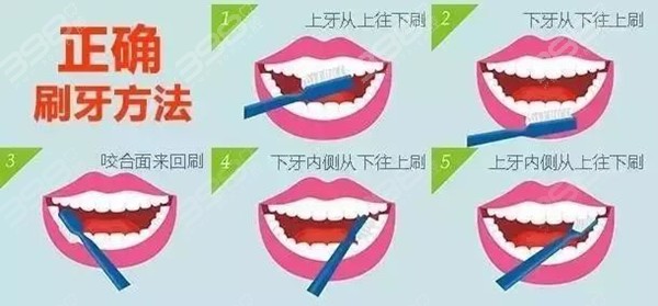 牙龈萎缩要怎么预防