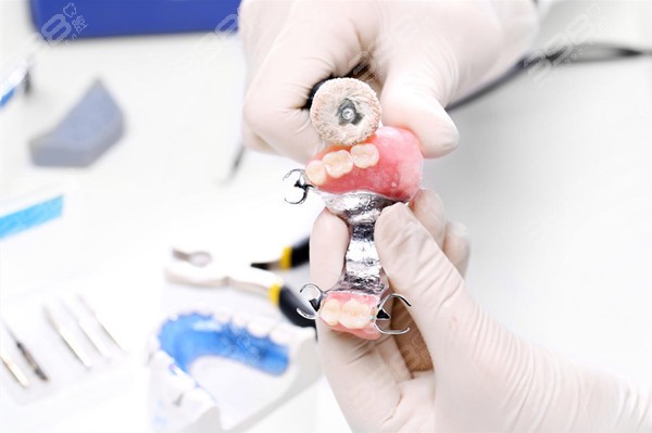 2023曲靖口腔医院收费价目表公开 烤瓷牙/种植牙/补牙都包含