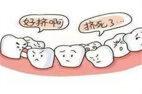 多牙症