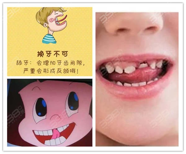 天津儿童看牙多少钱