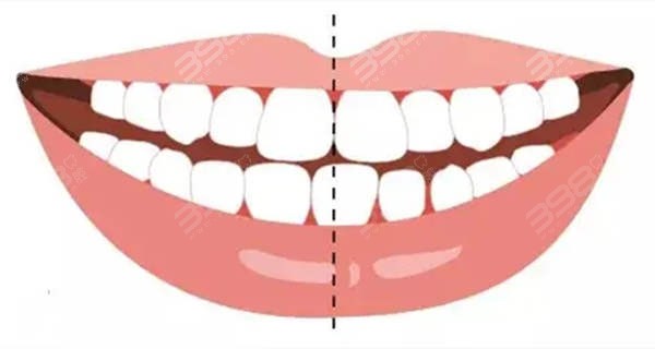 东莞牙状 元口腔医院牙齿矫正收费价目表