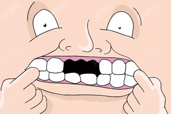 网友投稿：我拔牙后十多年没镶牙