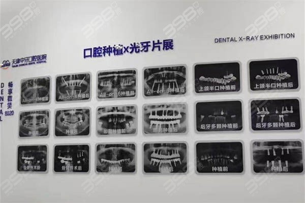 天津中牙口腔医院预约方式
