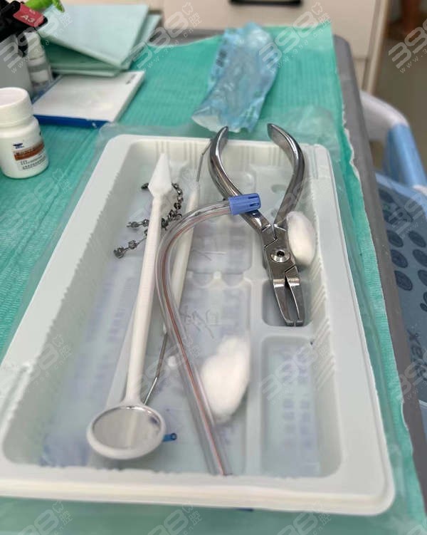 宁波牙博士口腔医院牙齿矫正多少钱