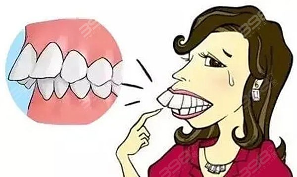 为什么说别再把舌头垫在牙齿中间了