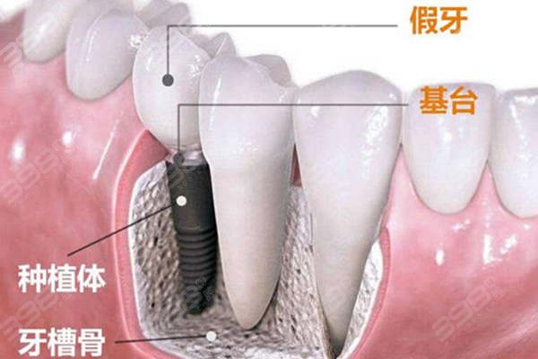 杭州拱墅区种植牙医院排名前十