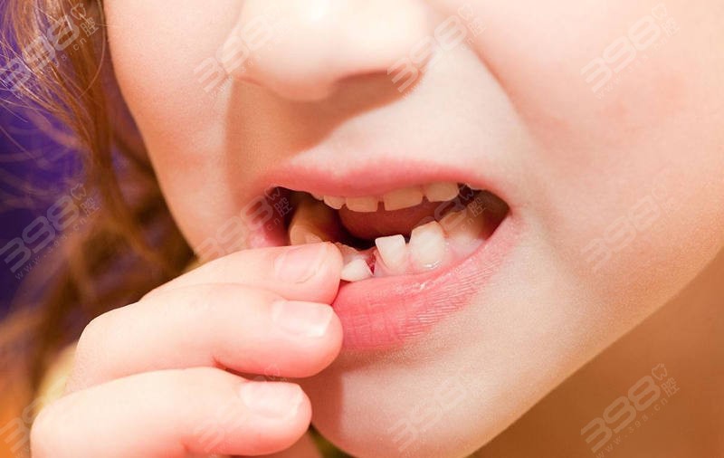未满18岁可以种植牙吗？牙缺失后的修复方式及适种人群一并告知