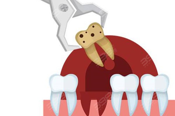 银川拔牙/拔智齿比较便宜还能走医 保的牙科推荐