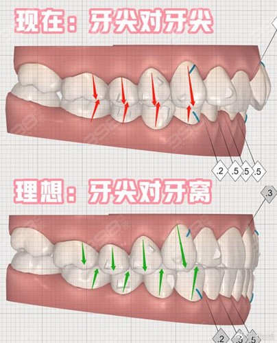 中山口腔医院牙齿矫正价目表