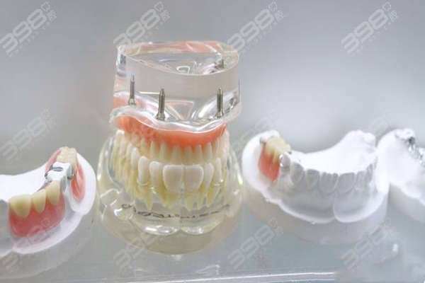 六盘水50岁种牙最好的口腔医院是哪家？排名前三的牙科实惠种牙成功率高