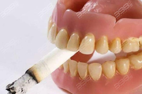 种植牙可以抽烟吗