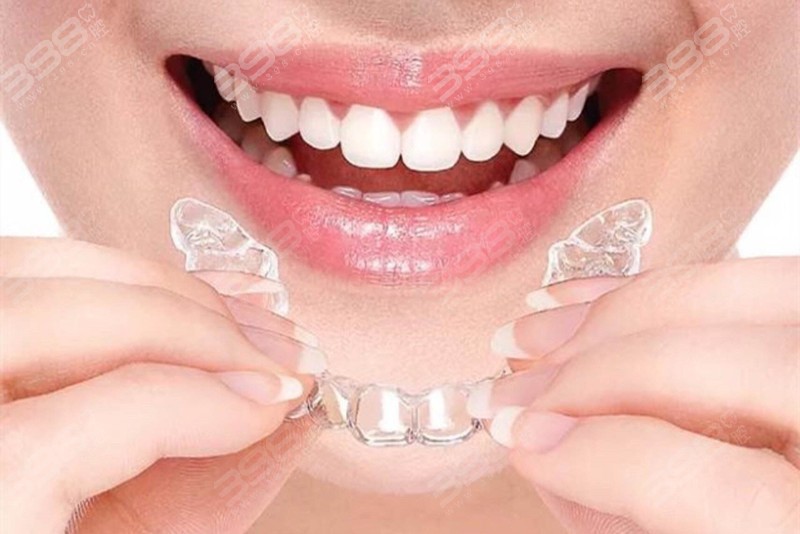 福州隐形矫正排名前十医院公布，维乐/登特/美可普口腔是便宜又好的牙科