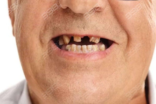 毕节老人种牙口腔医院top10谁比较好？刚更新2024年毕节口碑好的牙科