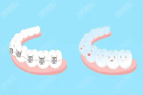 成都金属托槽矫正口腔医院排名：效果好技术赞值得面诊的牙科推荐