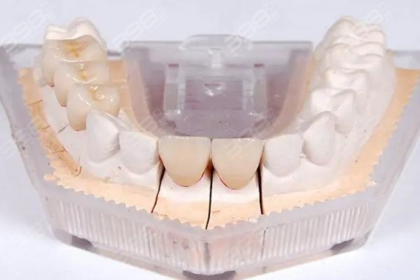 贵阳固定义齿便宜又好的医院推荐：柏德、牙博士、德韩镶牙好便宜技术赞