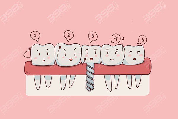 瑞尔齿科种植牙多少钱一颗