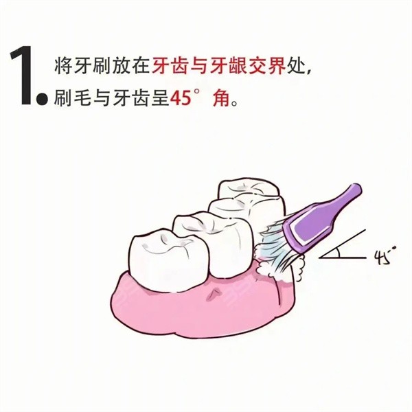 巴氏刷牙法图解1