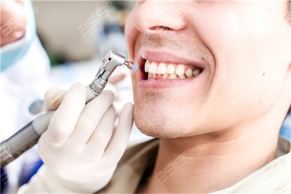 北京根管治疗一颗牙大概多少钱？除价格外带你了解北京根管治疗哪家好