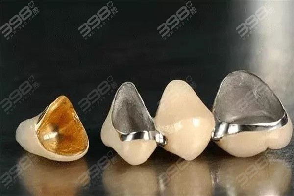 上海永华口腔全瓷牙、烤瓷牙多少钱一颗？