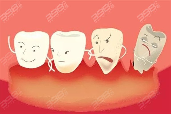 牙龈萎缩是可逆的吗？手把手教你各阶段保护牙齿的有效办法