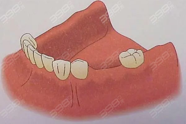 重庆渝中区进口种植牙排行榜：牙博士、美奥、亚太口腔种牙技术好yyds