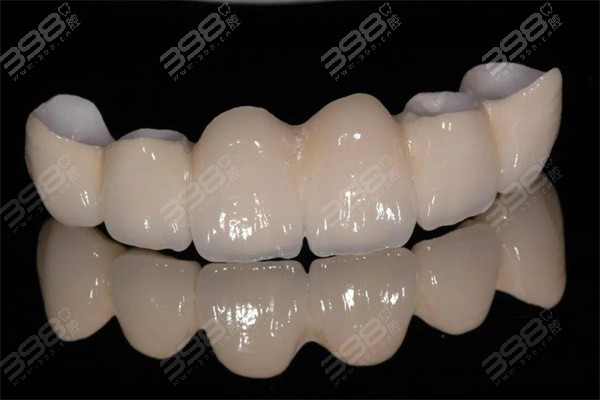 氟斑牙是怎么造成的？氟斑牙有没有什么比较好的美白方法