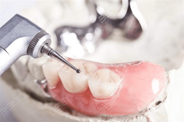 北京老年牙科医院排行榜：分享牙齿修复便宜又好还正规的牙科