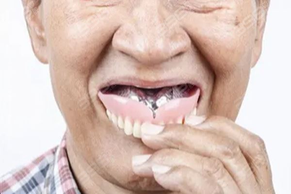 很多老人因为图省事晚上睡觉不摘假牙：那假牙到底需不需要清洗消毒