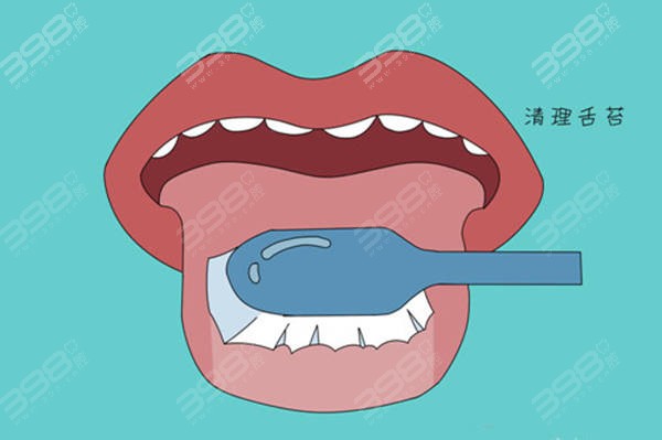 刷舌苔会不会减轻口臭？来看口臭的产生原因就晓得了