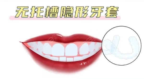 上海黄浦区隐形牙齿矫正价格表