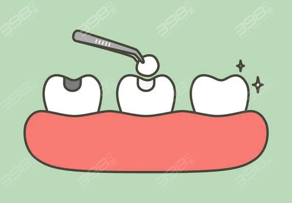 src=http%3A%2F%2Fwww.newpages2u.com%2Fuserfiles%2F20889%2Fimage%2Ftooth_amalgam_filling_with_dental_tools_vector_25059768.jpg&refer=http%3A%2F%2Fwww.newpages2u.webp.jpg