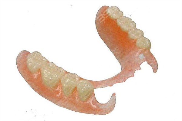 临时活动假牙能戴多久?3-10天但临时假牙和活动假牙的区别还蛮大的