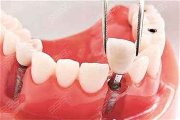 呼和浩特市种植牙医院排名前十