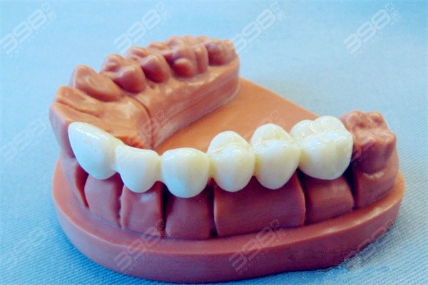 详解活动假牙的种类及价格,带老人了解哪种假牙材质好佩戴舒服
