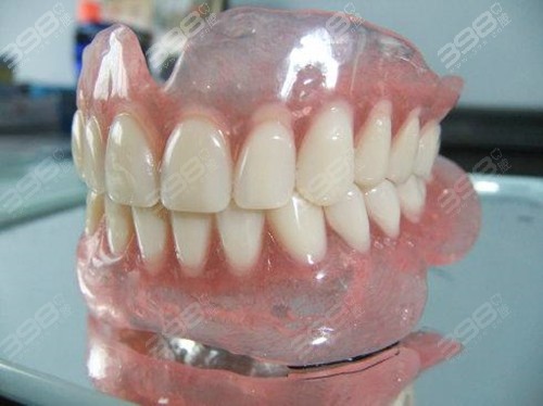 树脂活动义齿