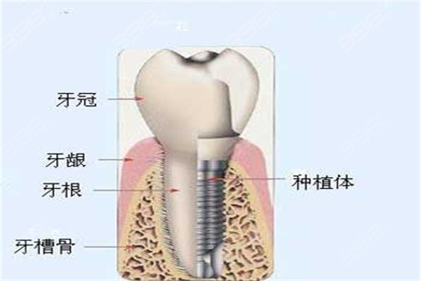 什么是牙槽骨
